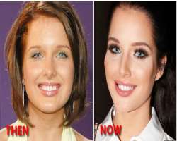 Helen Flanagan before surgery